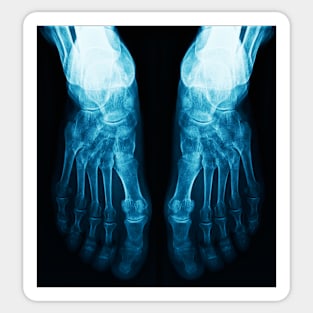 X-Ray Feet Sticker